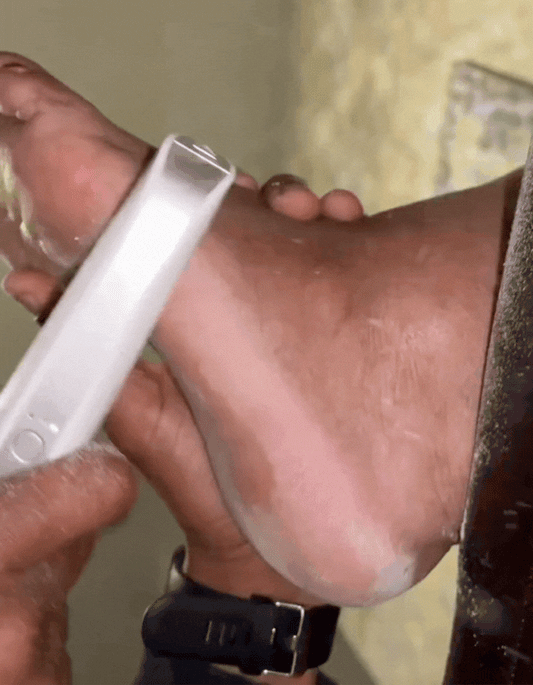 Removedor Eléctrico De Callos Recargable.